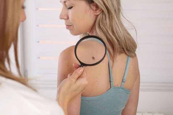 What Are Traditional Skin Lesion Removal Methods Market Drayton?
