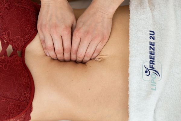 diastasis recti treatment Market Drayton