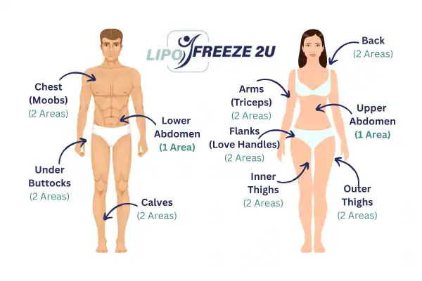 Areas you can have fat freezing treatment Market Drayton