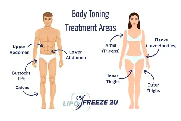 Graphic showing where you can have Body toning Treatment Market Drayton on your body