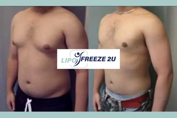 How Long Does It Take to See Results Market Drayton?