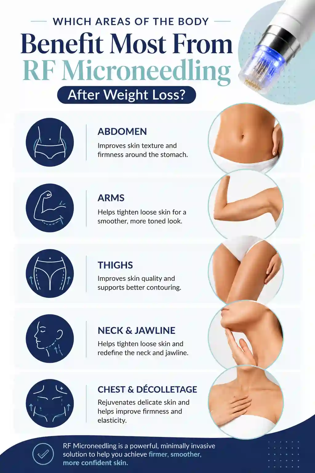Which Areas of the Body Benefit Most From RF Microneedling After Weight Loss Market Drayton